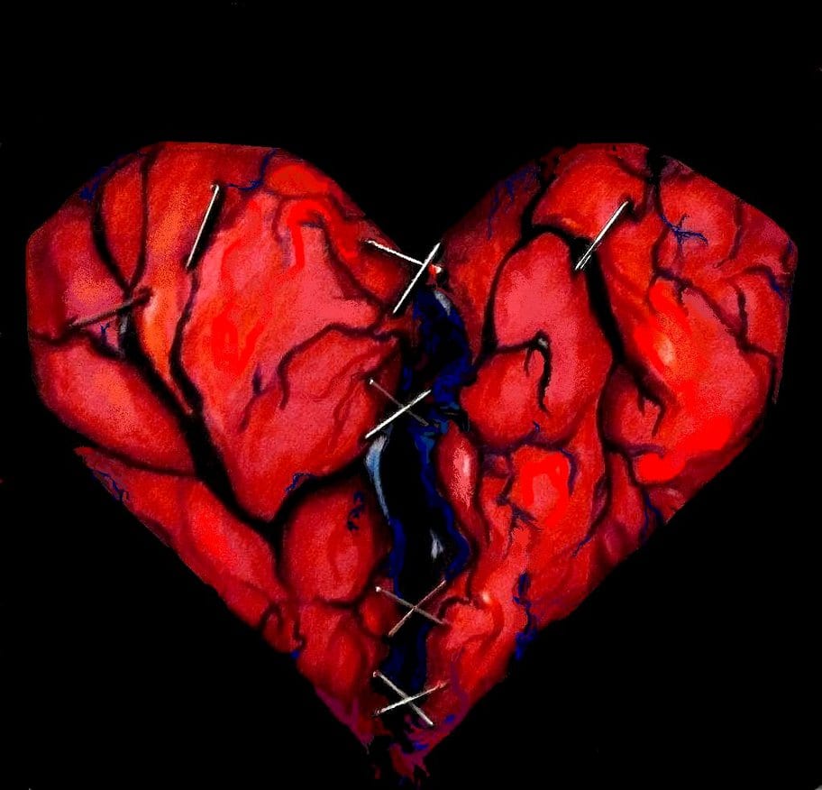 Stitched-Red-Broken-Heart